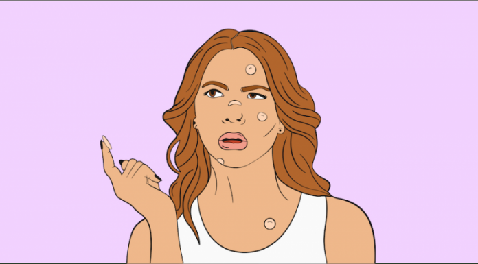 We asked Dr. Pimple Popper our biggest skin care questions—here are her juiciest tips