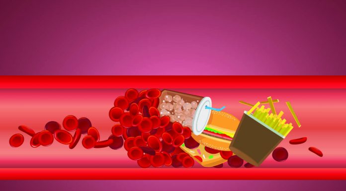 Ask The Doctor: What Should I Do About High Cholesterol? 